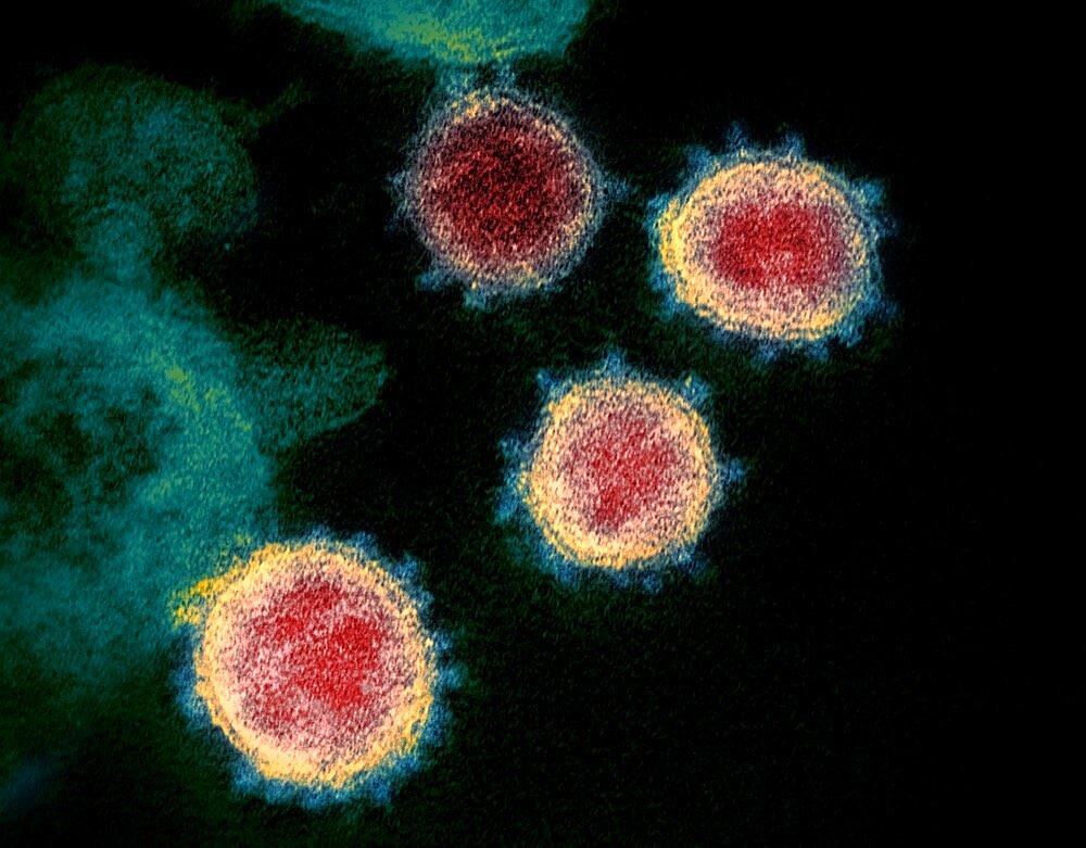 Coronavirus covid-19