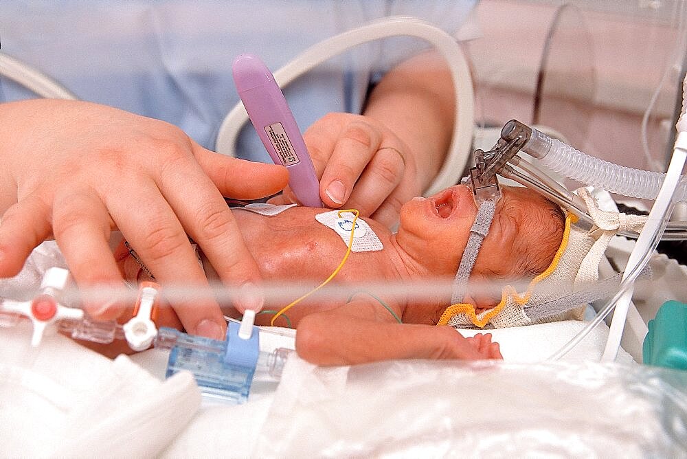 Neonatal Nurse Taking Temperature Of Premature Infant