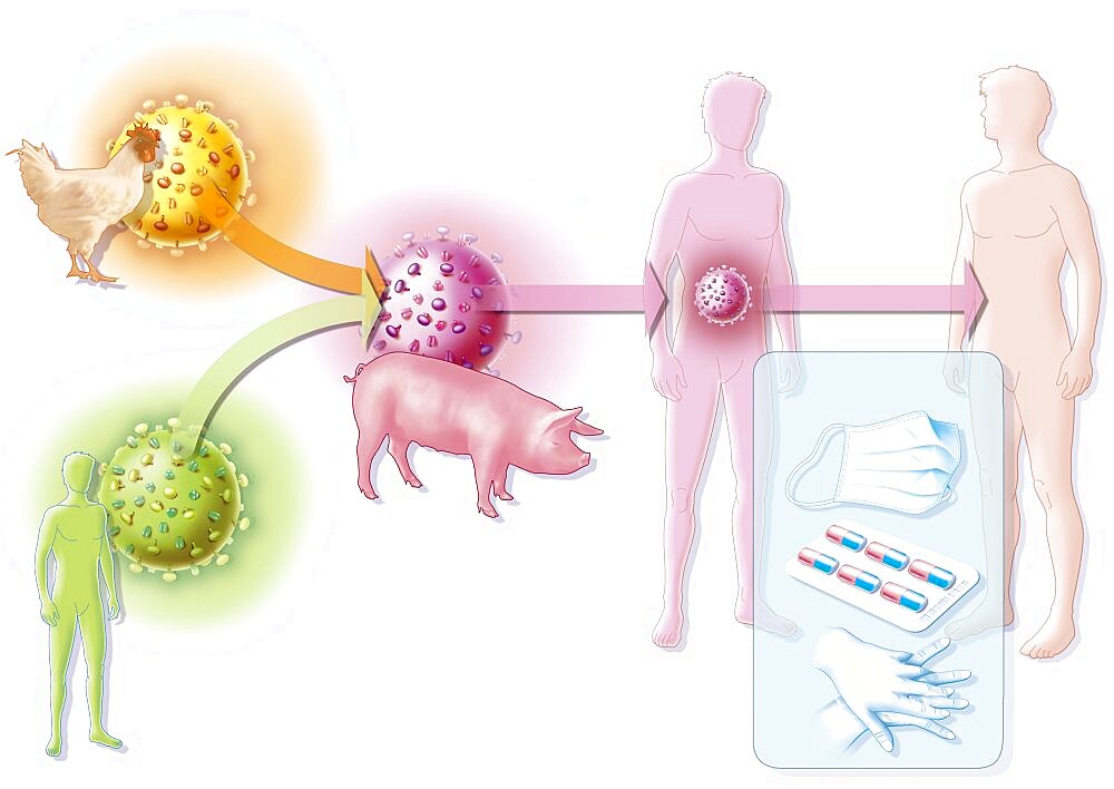 Influenza A H1N1 Infection