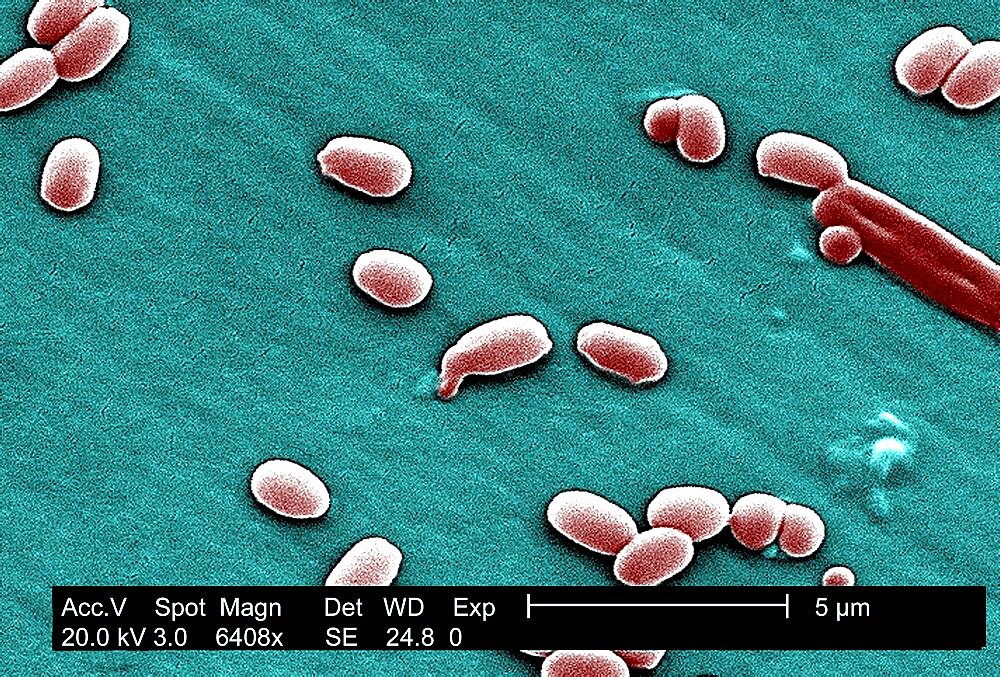 Anthrax Bacterium Spore, Sem