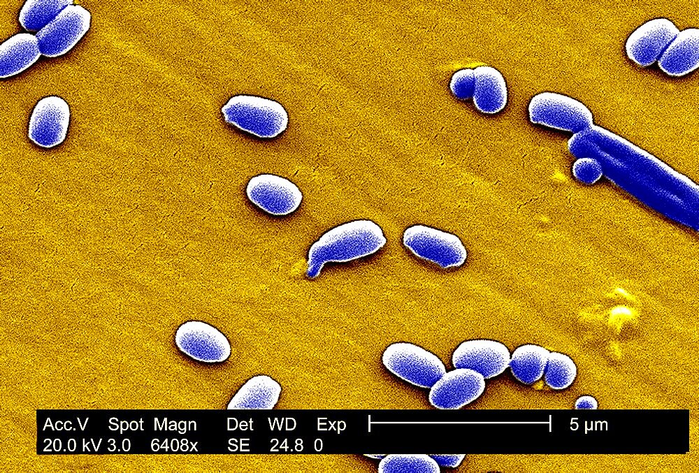 Anthrax Bacterium Spore, Sem