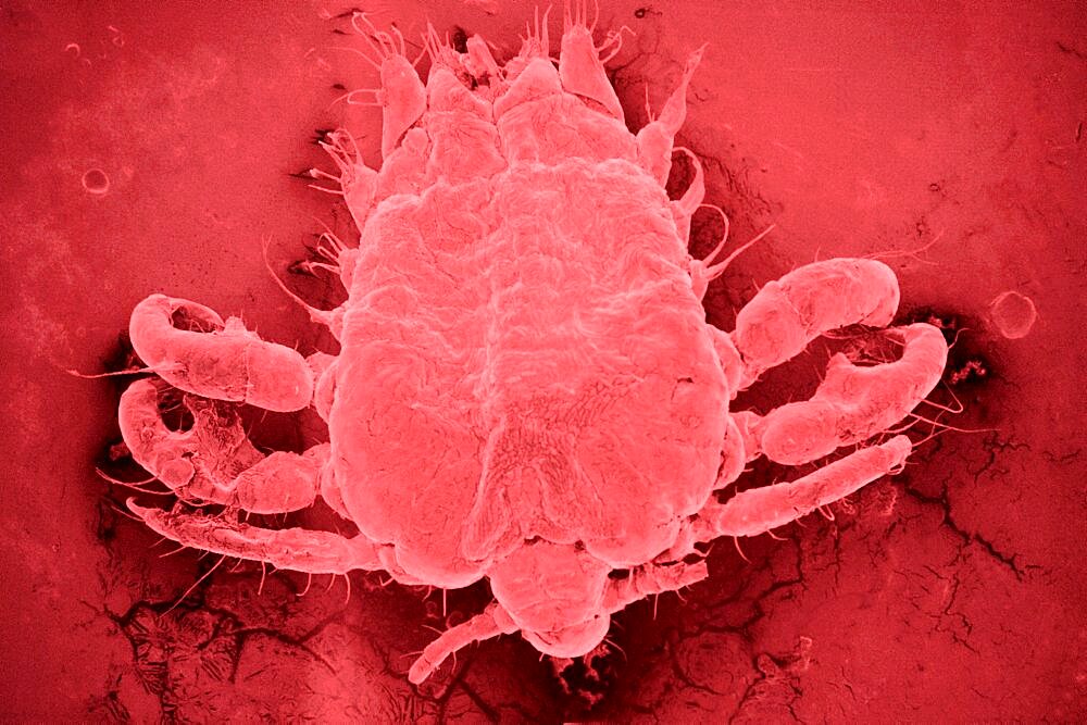 Crab Louse, Sem