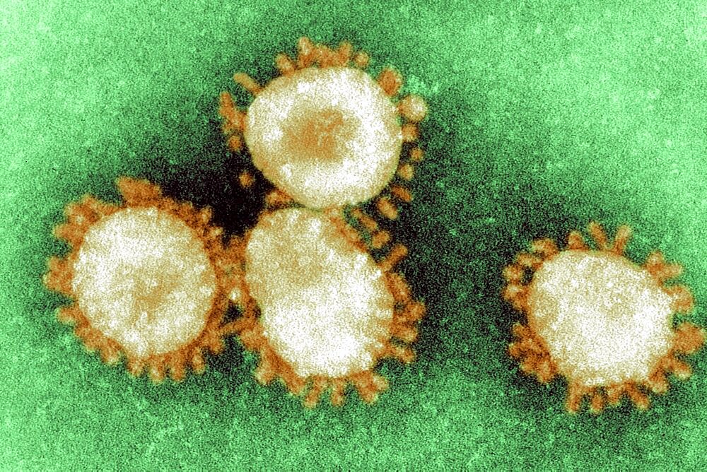 Coronavirus, Tem