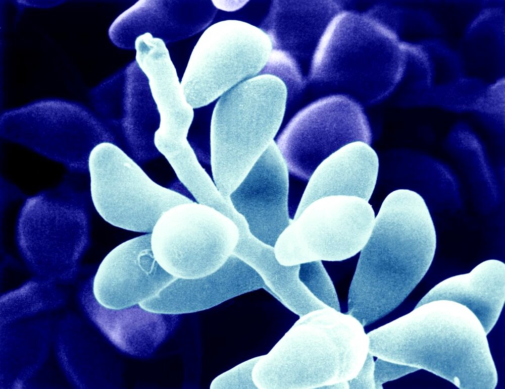 Curvularia Geniculata SEM