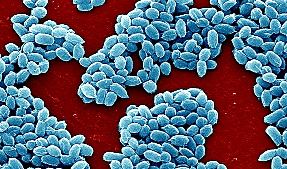 Anthrax Bacterium Spore, Sem