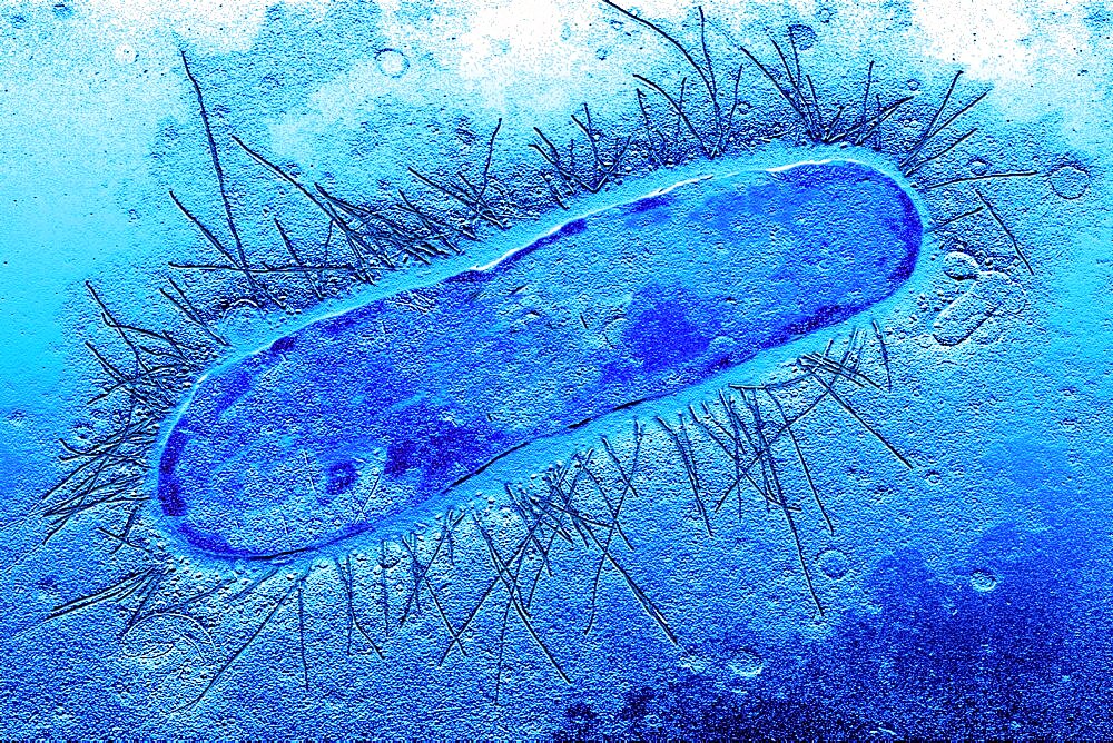 Escherichia Coli, Tem