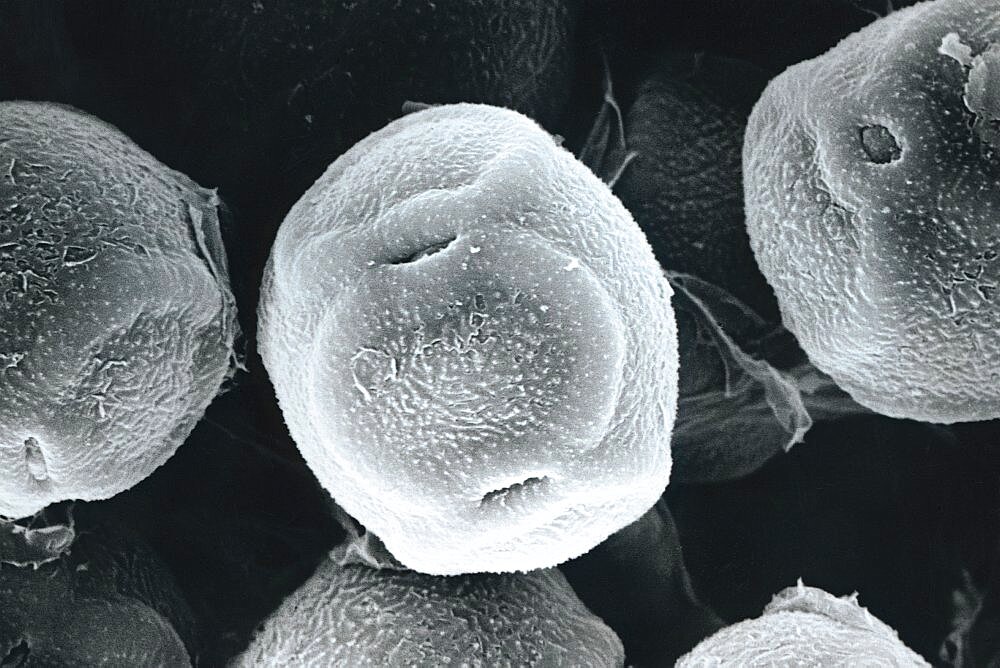 Alder Pollen SEM