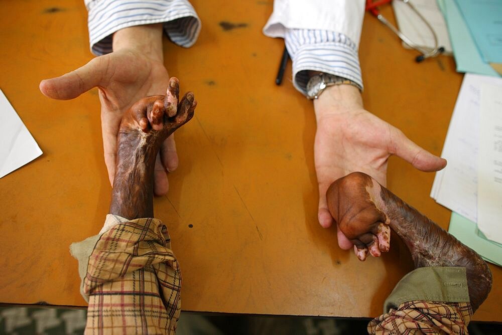 Humanitarian Medical Aide, Doctor Examines Scared Hands