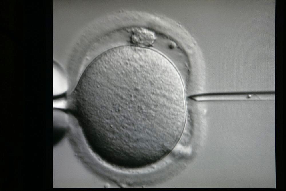 Intracytoplasmic sperm injection