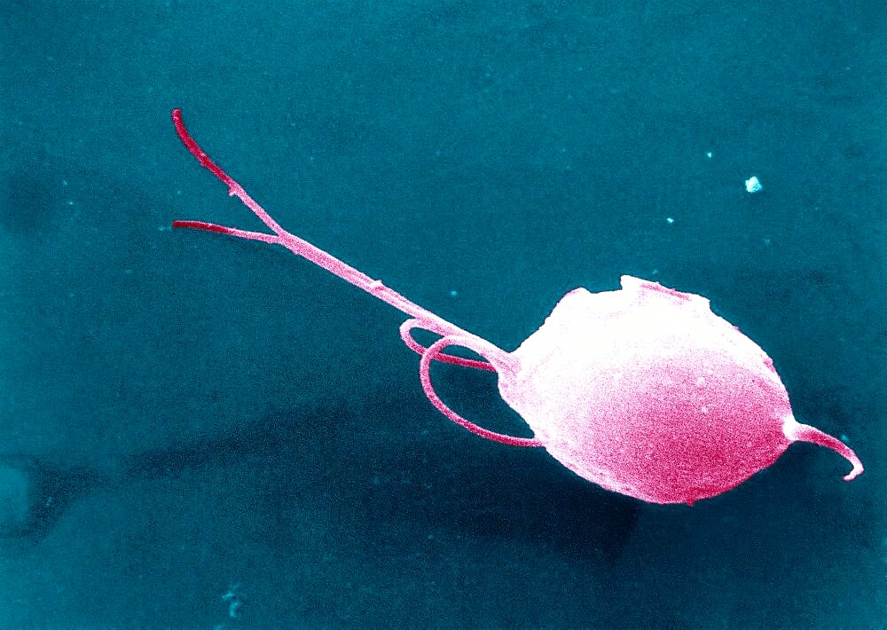 Trichomonas Vaginalis
