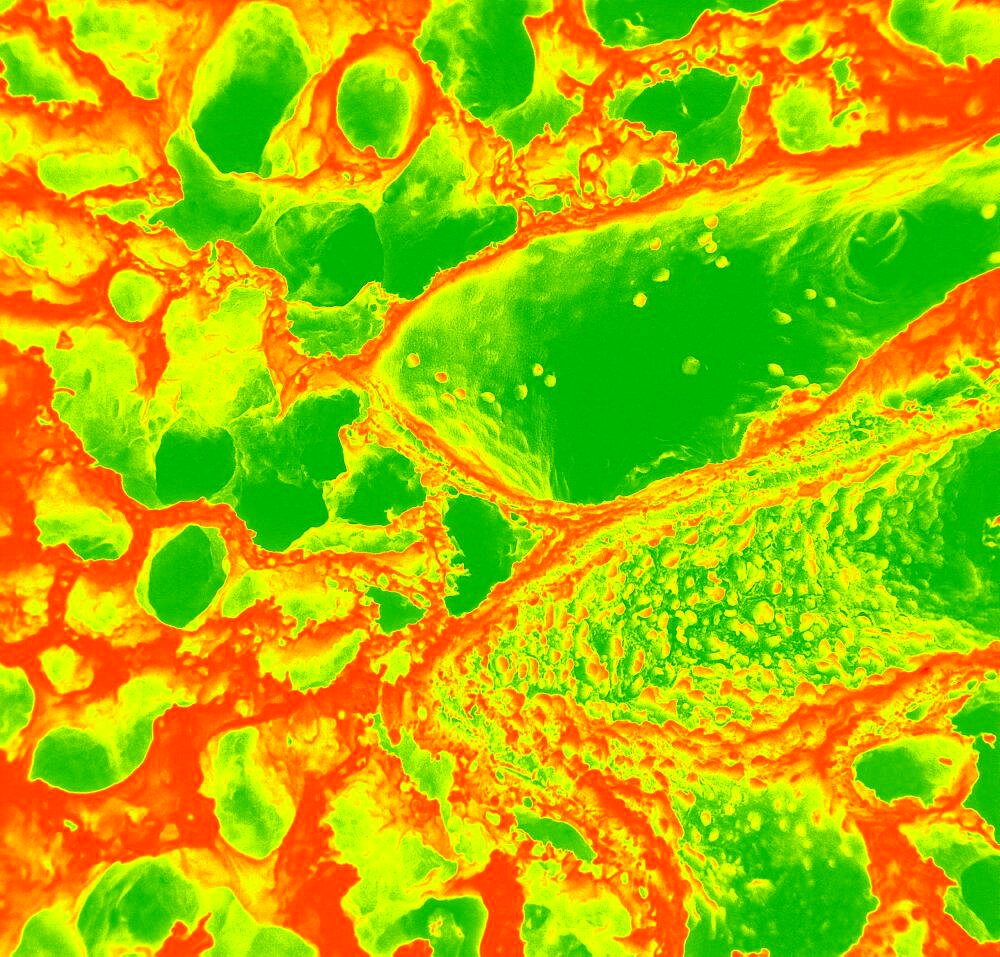 Lung Alveolus, SEM