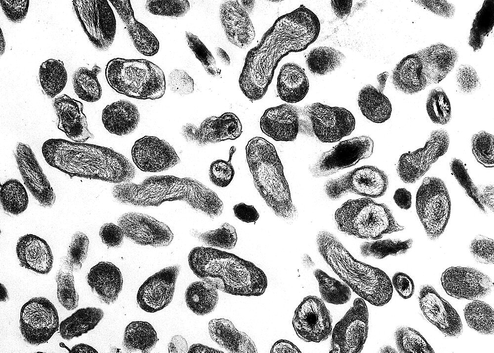 Coxiella burnetii, the bacteria that cause Q fever.