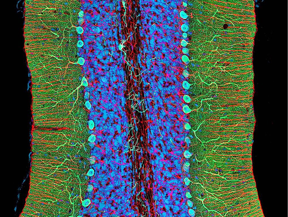 Cerebellum, Fluorescent LM