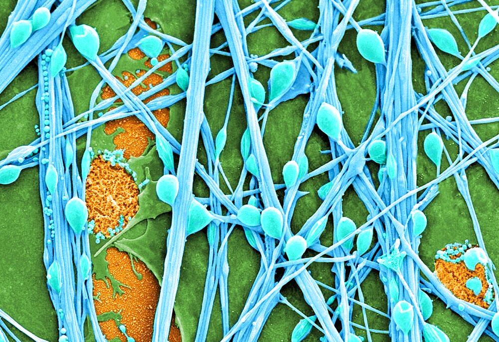 Neurons and Glial Cells, SEM