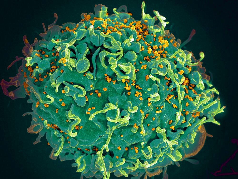 HIV, T Cell Under Attack, SEM