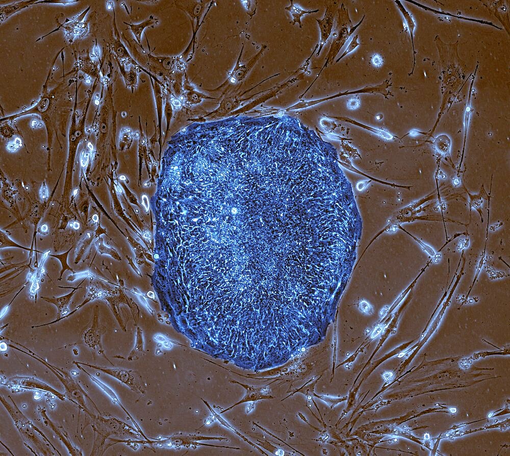 Human Induced Pluripotent Stem Cells, LM