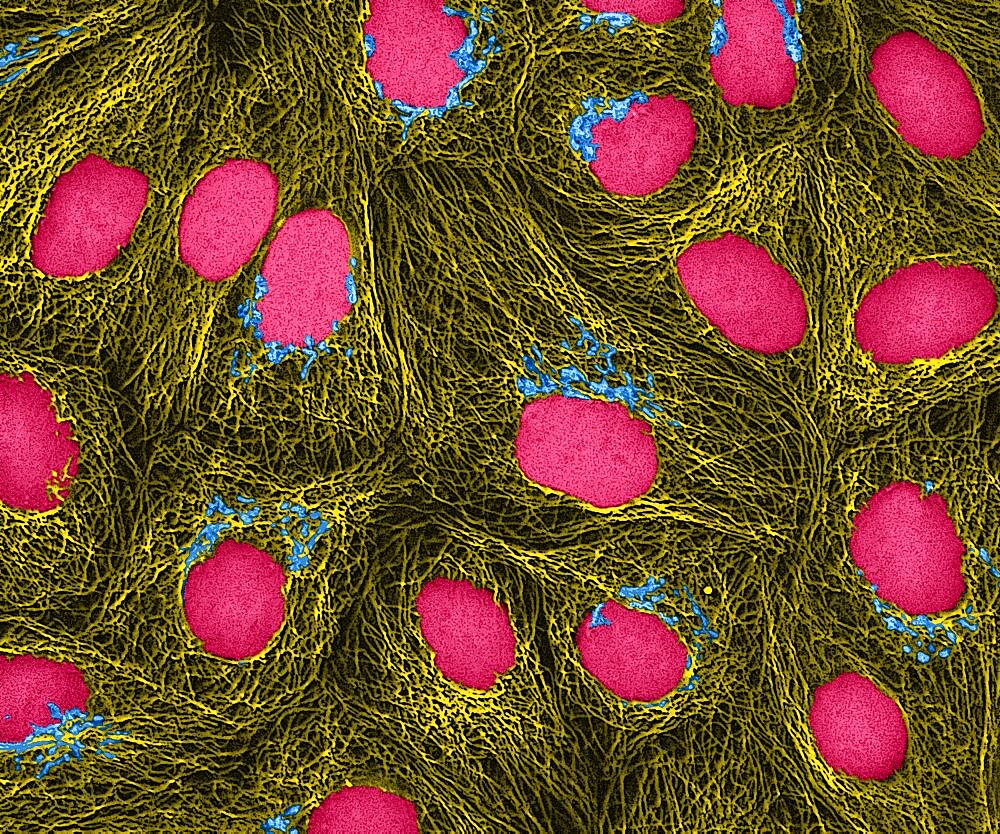 HeLa Cells, MFM