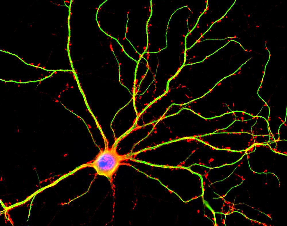 Hippocampal Neuron in Culture