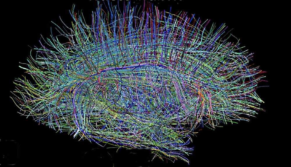 Neural Fibers in Human Brain