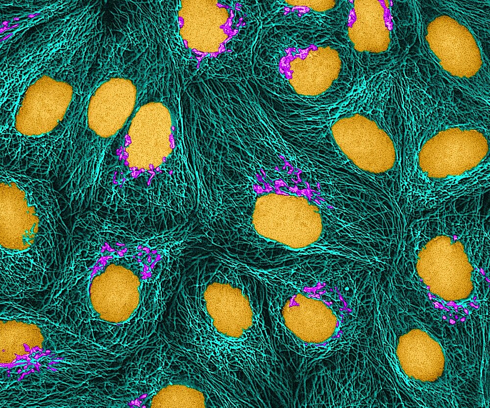 HeLa Cells, MFM