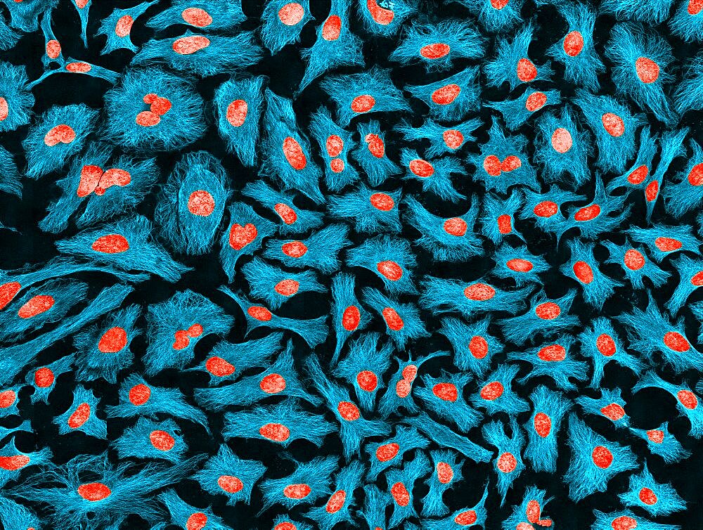 HeLa Cells, MFM