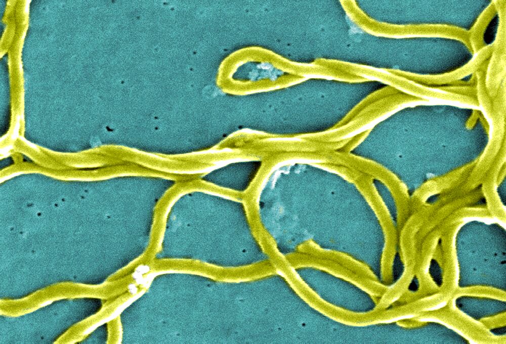 Lyme Disease, Borrelia burgdorferi Bacteria, SEM