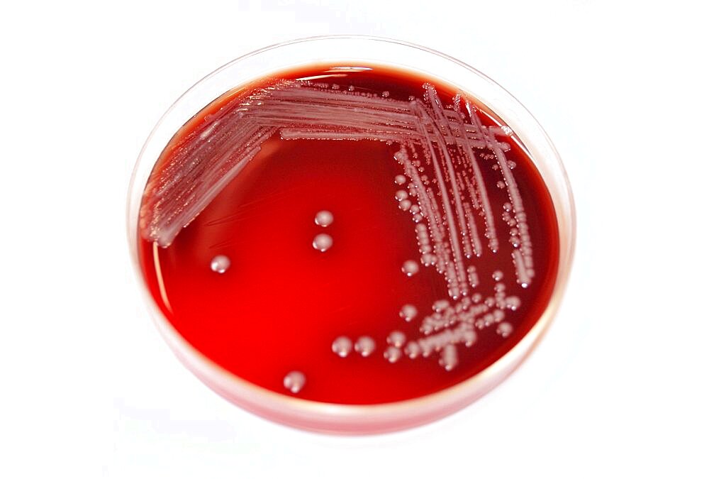 Petri Dish with Plague Bacteria