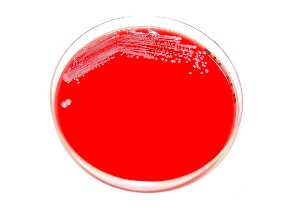 Petri Dish with Plague Bacteria