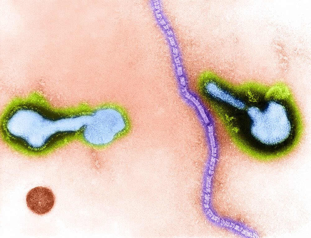 Parainfluenza Virus, TEM