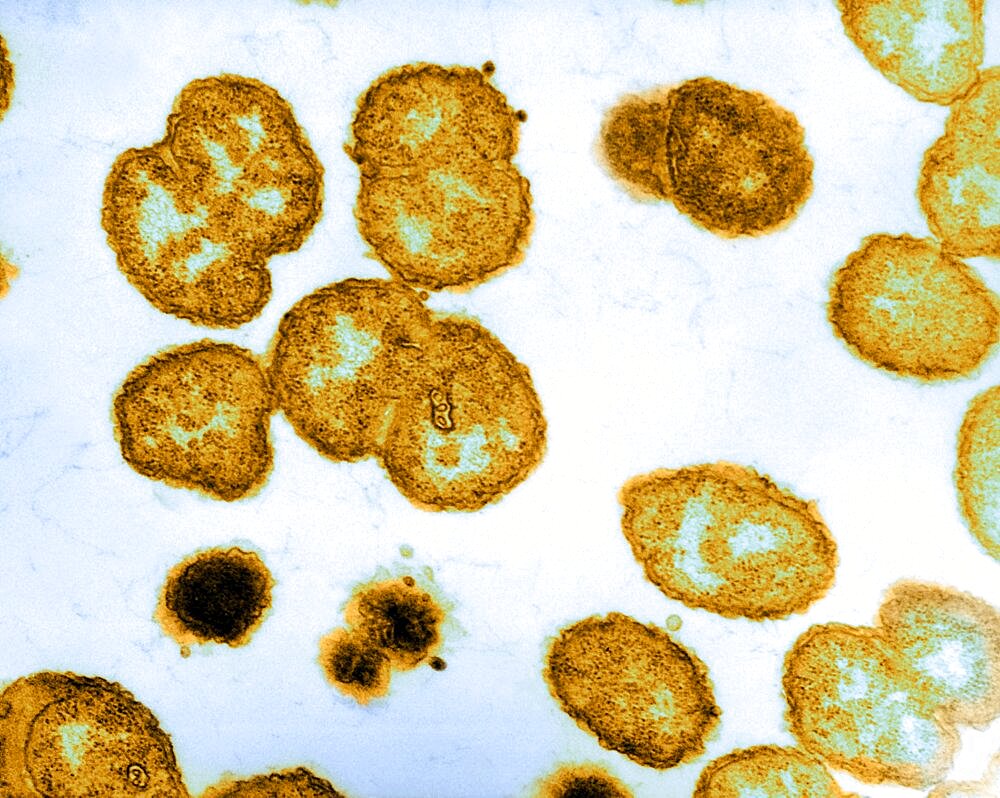 Neisseria gonorrhoeae Bacteria, TEM