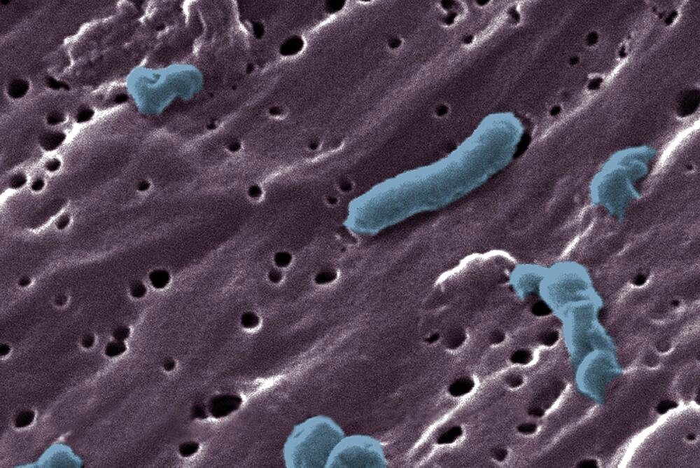 Vibrio cholerae Bacteria, SEM
