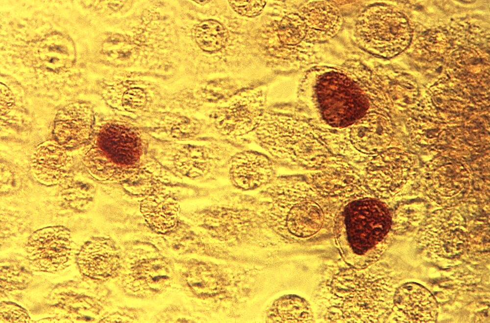 STD, Chlamydia trachomatis Bacteria, LM