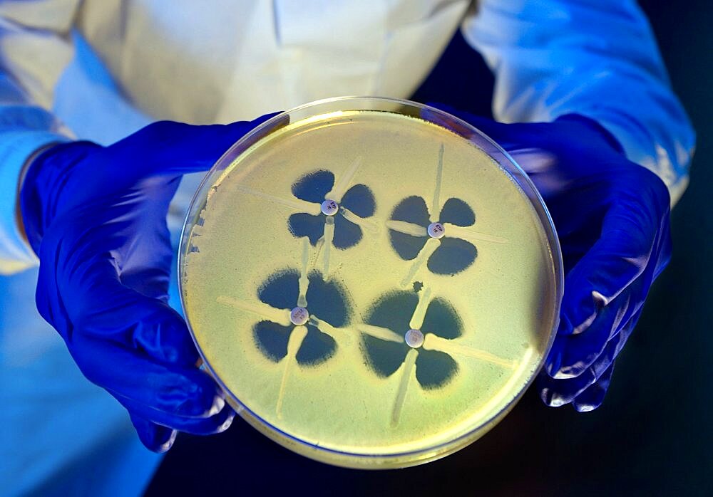 Antibiotic-Resistant Research, 2014