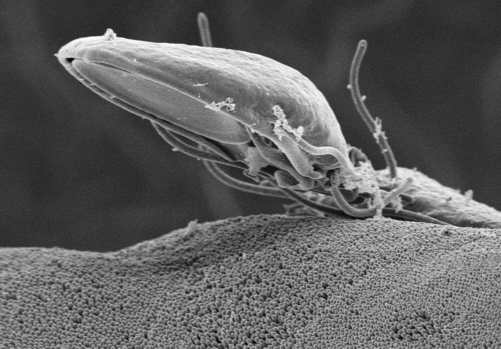 Giardia Protozoan, SEM