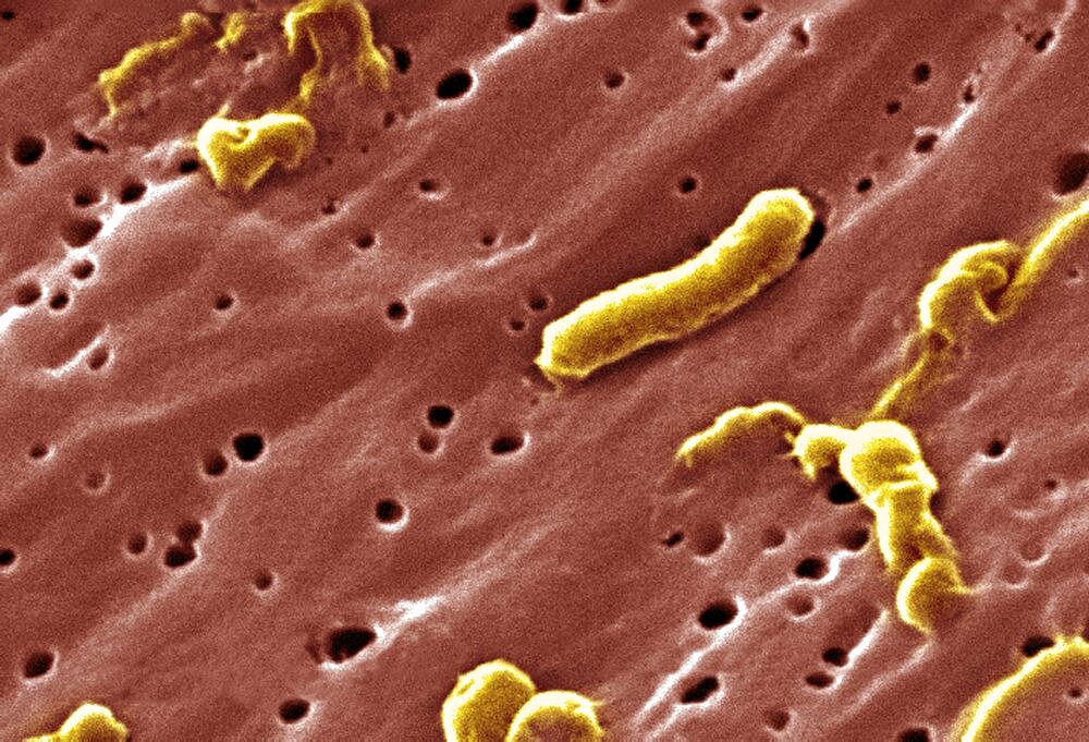 Vibrio cholerae Bacteria, SEM