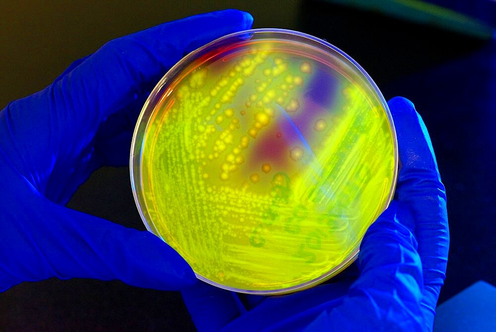 Clostridium difficile Bacteria, Culture Plate