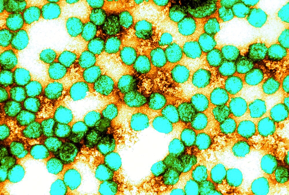 Flavivirus, Yellow Fever Virus, TEM