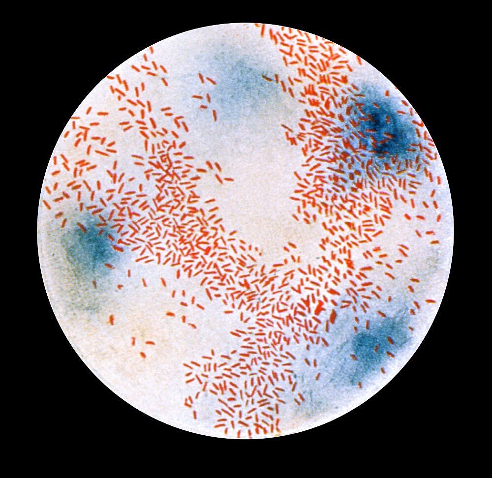 Haemophilus influenzae Bacteria, LM