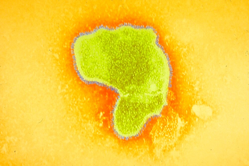 HRSV, Human Respiratory Syncytial Virus, TEM