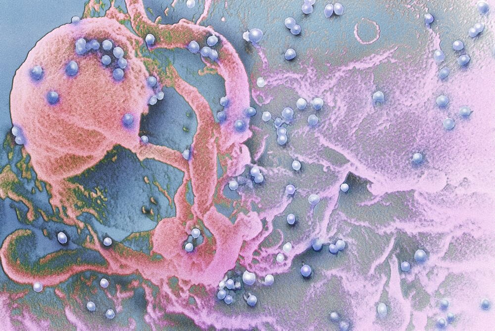 HIV Virus Budding from T-Lymphocyte, SEM