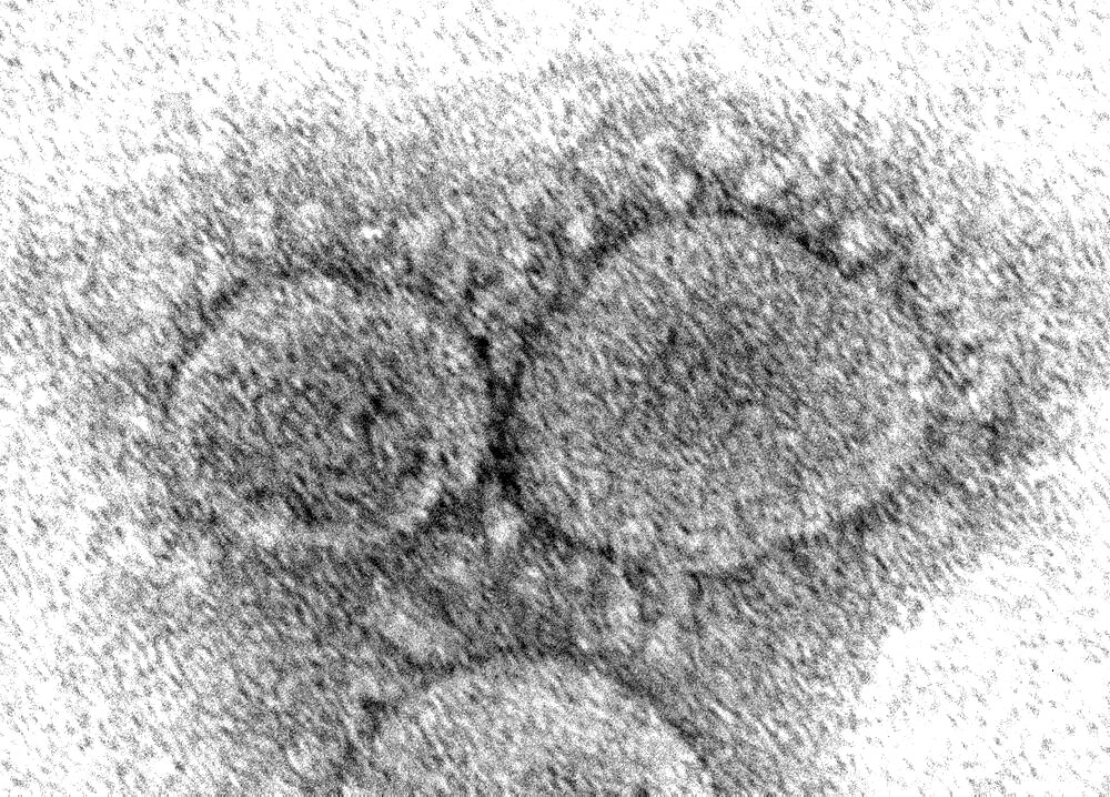 SARS-CoV-2, COVID-19 Virus, TEM