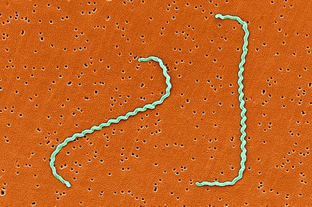 Leptospira interrogans Bacteria, SEM