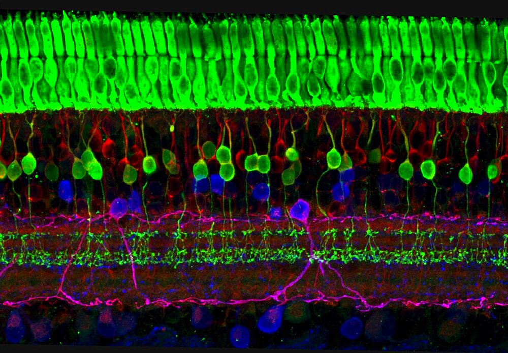 Retina, Photoreceptors