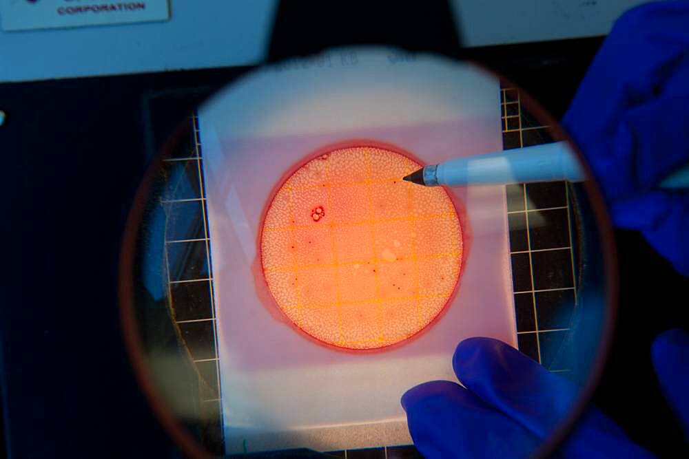 Scientist counting cultures on a petri dish