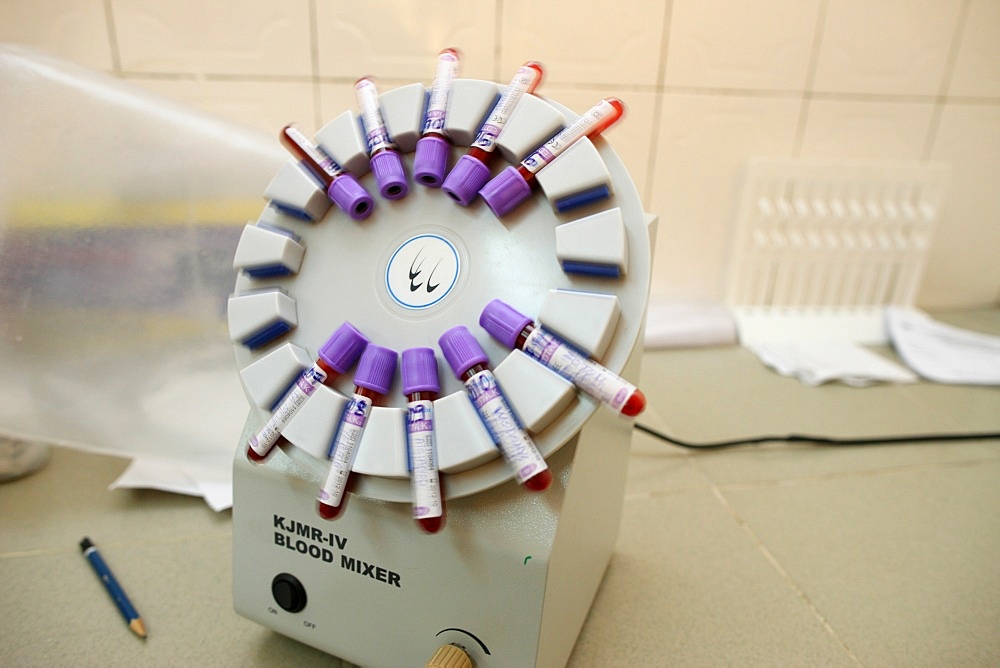 Laboratory at Medical center for HIV positive patients, Lome, Togo, West Africa, Africa