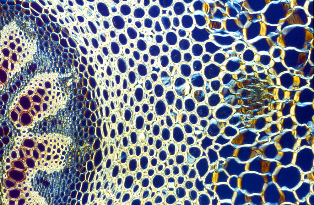 Light Micrograph (LM) of a transverse section of a stem of Clubmoss (Lycopodium sp.), magnification x 600