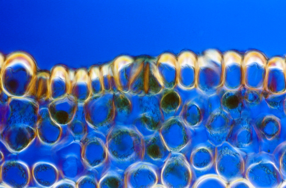 Light Micrograph (LM) of a transverse section of a stem of Whisk Fern (Psilotum nudum), magnification x 1200