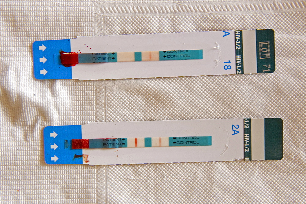 HIV test, a visual line at both the test and control sites indicates a positive test result, bottom, Quelimane, Mozambique, Africa