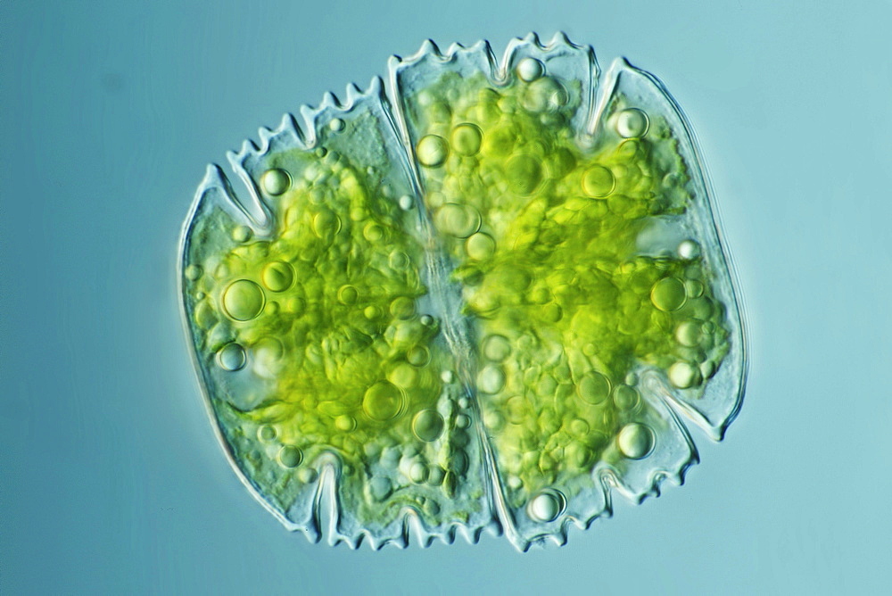 desmid alga desmid differential interference contrast microscopy DIC