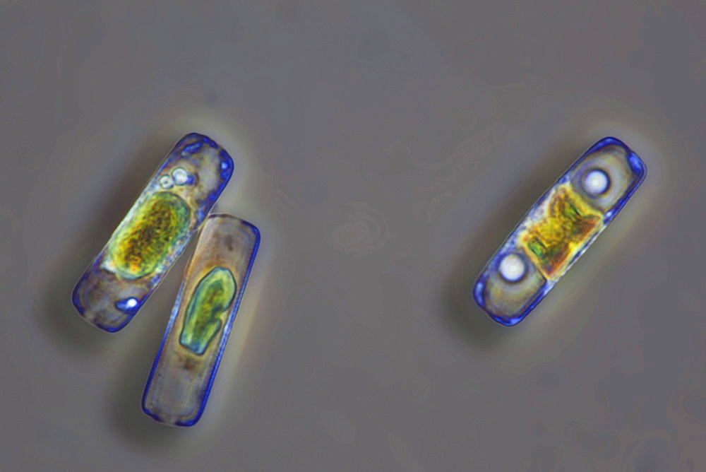 diatoms diatom phase contrast microscopy